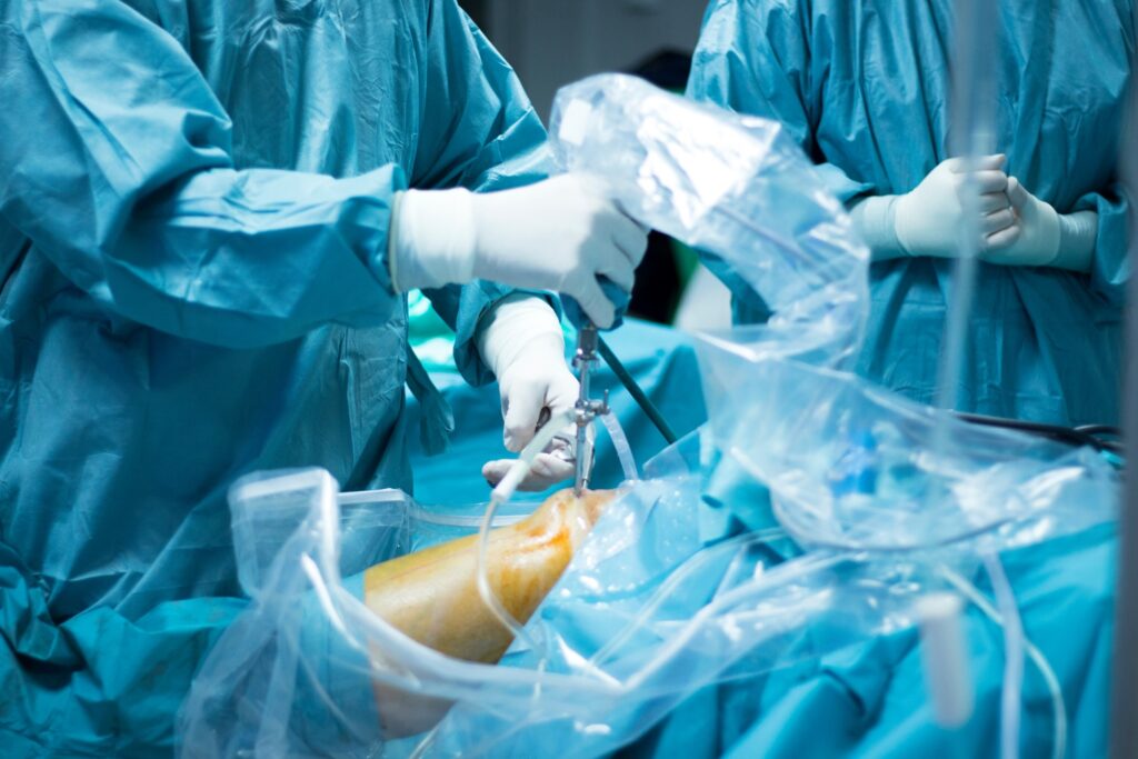 Understanding Knee Arthroscopy