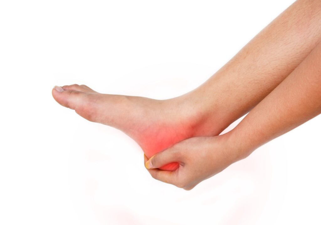 Plantar Fasciitis: Understanding and Managing Heel Pain